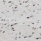 Immunohistochemical staining of human cerebral cortex shows strong cytoplasmic positivity in neuronal cells.