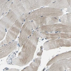 Immunohistochemical staining of human skeletal muscle shows weak cytoplasmic positivity in myocytes.
