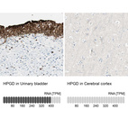 Anti-HPGD Antibody