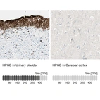Anti-HPGD Antibody