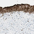 Immunohistochemical staining of human urinary bladder shows strong cytoplasmic positivity in urothelial cells.