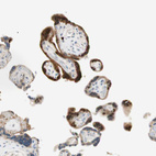 Immunohistochemical staining of human placenta shows moderate to strong cytoplasmic positivity in trophoblastic cells.