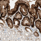 Immunohistochemical staining of human stomach shows moderate to strong cytoplasmic and membranous positivity in glandular cells.