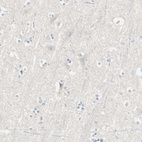 Immunohistochemical staining of human cerebral cortex shows no positivity in neurons as expected.