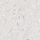 Anti-HPGD Antibody