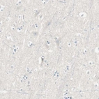 Immunohistochemical staining of human cerebral cortex shows no positivity in neurons as expected.