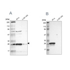 Western blot analysis using Anti-HPGD antibody HPA004919 (A) shows similar pattern to independent antibody HPA005679 (B).
