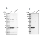Western blot analysis using Anti-HPGD antibody HPA004919 (A) shows similar pattern to independent antibody HPA005679 (B).