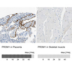 Anti-PROM1 Antibody