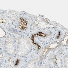 Immunohistochemical staining of human kidney shows moderate to strong positivity in apical membrane in cells in tubules.