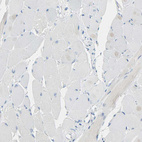 Immunohistochemical staining of human skeletal muscle shows moderate to strong positivity in myocytes.