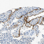 Immunohistochemical staining of human placenta shows strong membranous positivity in decidual cells.