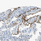 Immunohistochemical staining of human placenta shows strong membranous positivity in decidual cells.