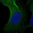 Immunofluorescent staining of human cell line U-251 MG shows localization to cytosol.