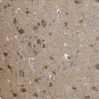 Immunohistochemical staining of human cerebral cortex shows strong cytoplasmic positivity in neurons.
