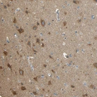 Immunohistochemical staining of human cerebral cortex shows strong cytoplasmic positivity in neurons.