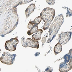 Immunohistochemical staining of human placenta shows moderate cytoplasmic positivity in trophoblastic cells.