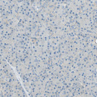 Immunohistochemical staining of human pancreas shows no cytoplasmic positivity in exocrine glandular cells as expected.