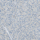 Anti-TSC22D2 Antibody