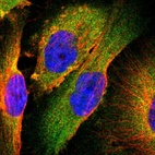 Immunofluorescent staining of human cell line U-251 MG shows localization to cytosol.