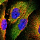 Immunofluorescent staining of human cell line U-251 MG shows localization to cytosol.