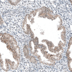 Anti-HTR1E Antibody
