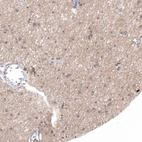 Immunohistochemical staining of human cerebral cortex shows moderate positivity in neuropil.