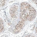 Immunohistochemical staining of human testis shows moderate membranous positivity in cells in seminiferous ducts.