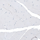 Immunohistochemical staining of human skeletal muscle shows no positivity in myocytes as expected.