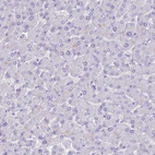 Immunohistochemical staining of human liver shows low expression as expected.