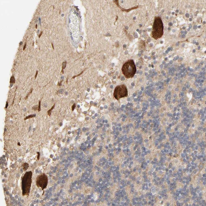 Anti-CLEC4E Antibody