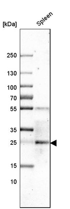 Western blot analysis in human spleen tissue.