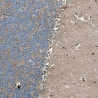 Immunohistochemical staining of human cerebellum shows moderate cytoplasmic positivity in neuronal processes.