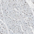 Immunohistochemical staining of human heart shows strong positivity in cardiomyocytes.