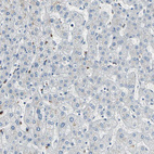 Anti-PTGDS Antibody