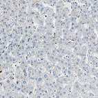 Immunohistochemical staining of human liver shows no positivity in hepatocytes as expected.
