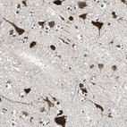 Anti-AATF Antibody