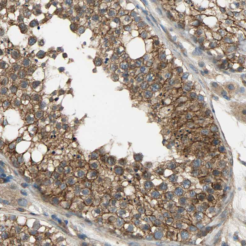 Anti-KIAA1217 Antibody