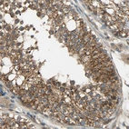 Anti-KIAA1217 Antibody