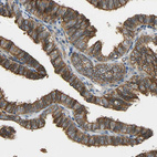 Immunohistochemical staining of human Fallopian tube shows moderate membranous positivity in glandular cells.