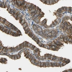 Immunohistochemical staining of human Fallopian tube shows moderate membranous positivity in glandular cells.