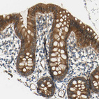 Immunohistochemical staining of human colon shows moderate cytoplasmic and membranous positivity in glandular cells.