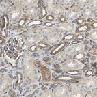 Immunohistochemical staining of human kidney shows moderate cytoplasmic and membranous positivity in cells in distal tubules.