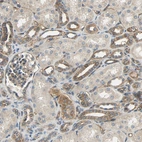 Immunohistochemical staining of human kidney shows moderate cytoplasmic and membranous positivity in cells in distal tubules.