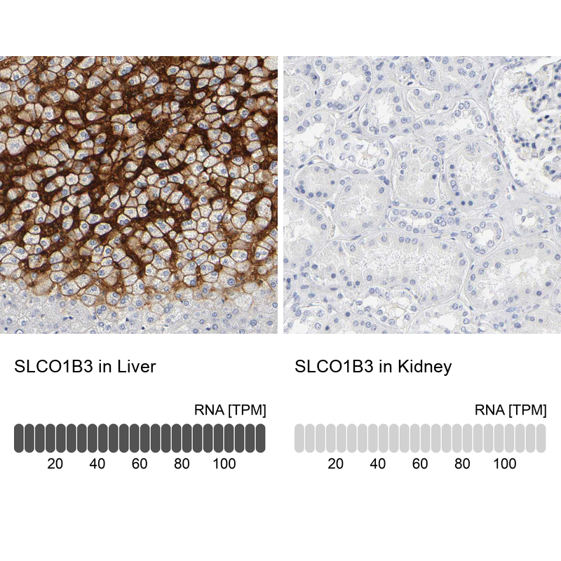 Anti-SLCO1B3 Antibody