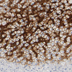 Anti-SLCO1B3 Antibody