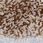 Immunohistochemical staining of human liver shows strong membranous positivity in hepatocytes.