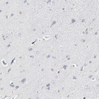 Immunohistochemical staining of human cerebral cortex shows no positivity in neurons as expected.