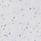 Immunohistochemical staining of human cerebral cortex shows no positivity in neurons as expected.