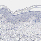 Anti-SLCO1B3 Antibody